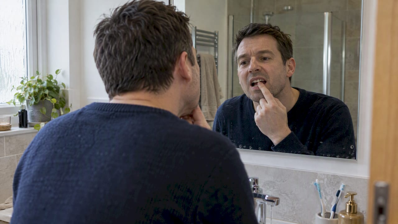 Emergency Chipped Tooth: What to Do and When to Worry