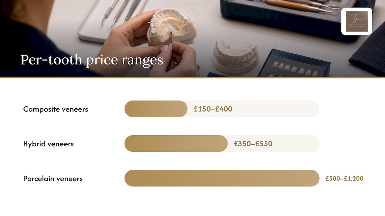 UK veneer price ranges by material and region