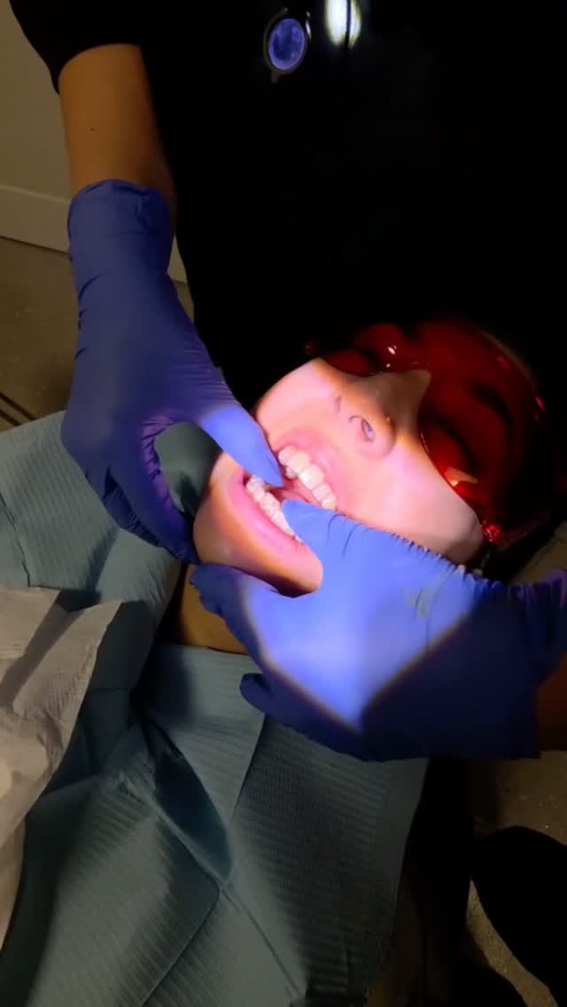The first day of your Invisalign treatment is all about getting you comfortable with your new aligners and making sure you know exactly what to…