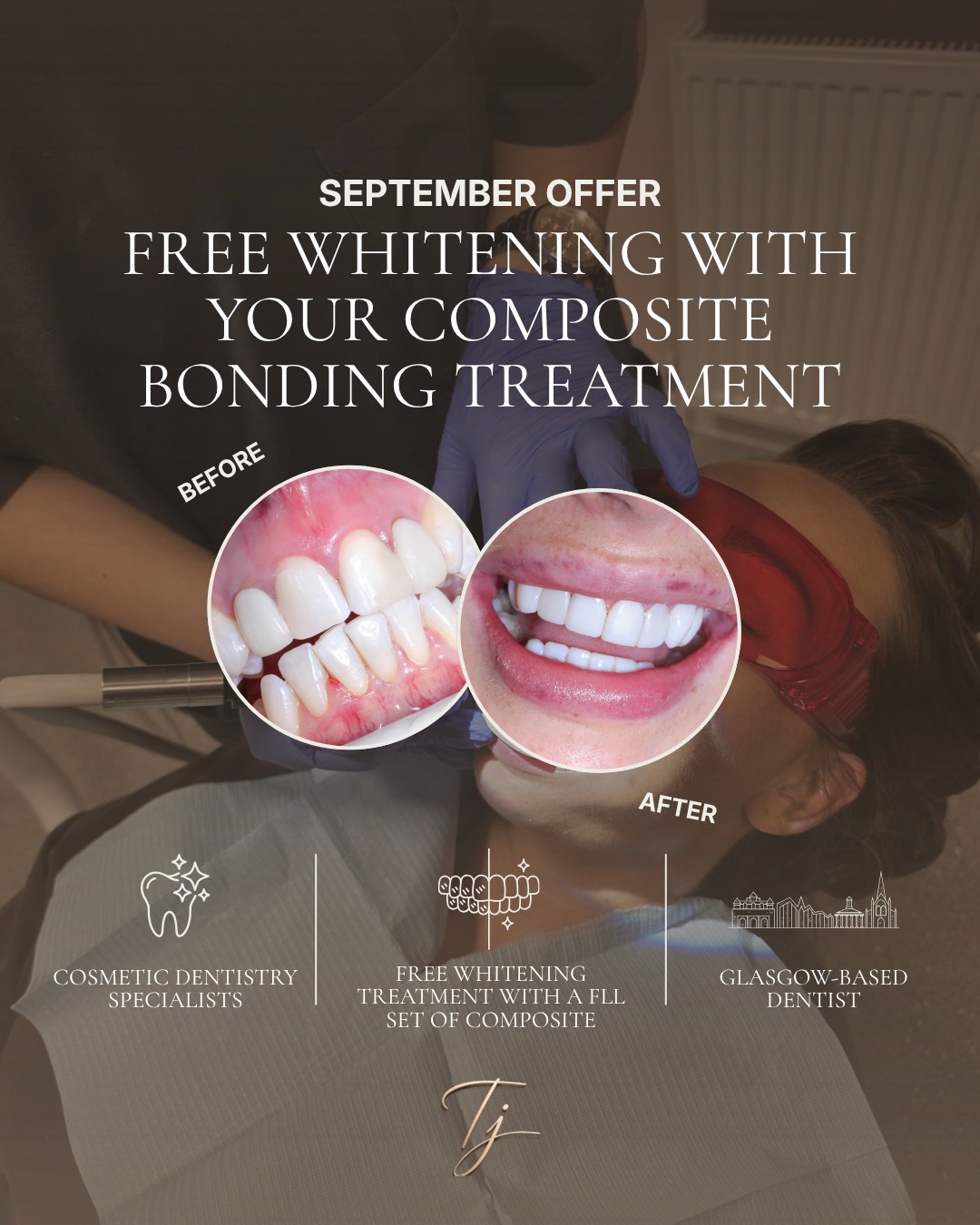 Ready to fall in love with your smile? For a limited time, every full set of composite bonding comes with a FREE whitening treatment. Straighter…
