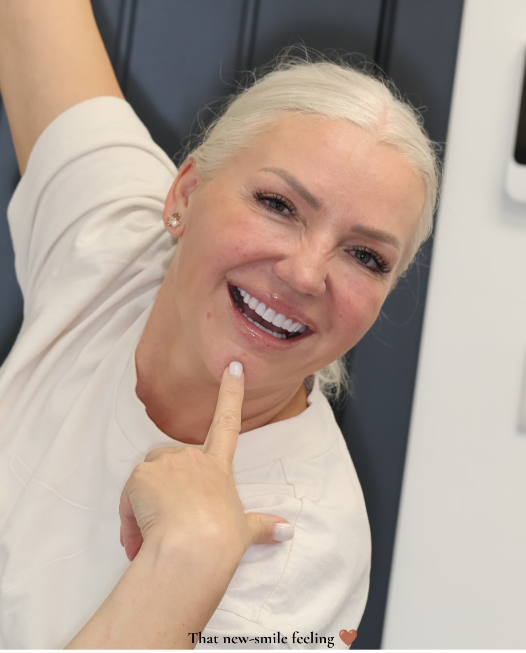 ✨ A smile worth celebrating. There’s nothing better than seeing that confidence at the end of a smile transformation. 🤎 This smile was carefully… — image 4 of 5
