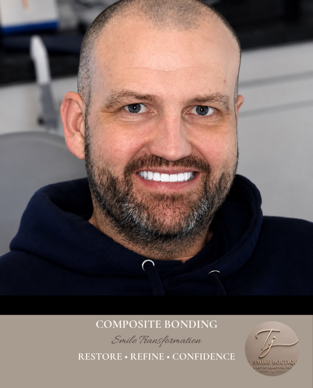 ✨ Smile Transformation with Composite Bonding ✨ Every smile is unique, and every treatment should be too. For this patient, the goal was to enhance… — image 1 of 4