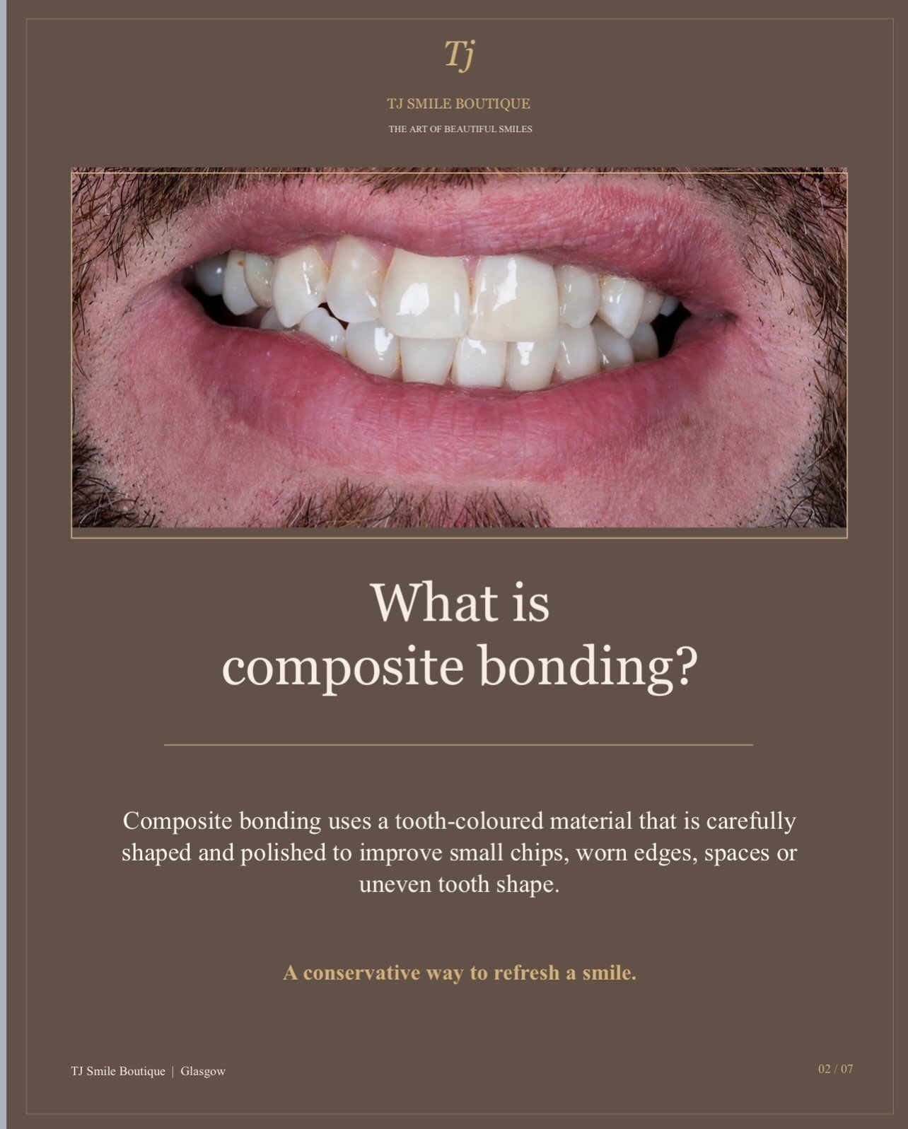Composite bonding or teeth whitening — which comes first? ✨ For many smile-makeover cases, teeth whitening is completed first so the natural teeth… — image 2 of 12