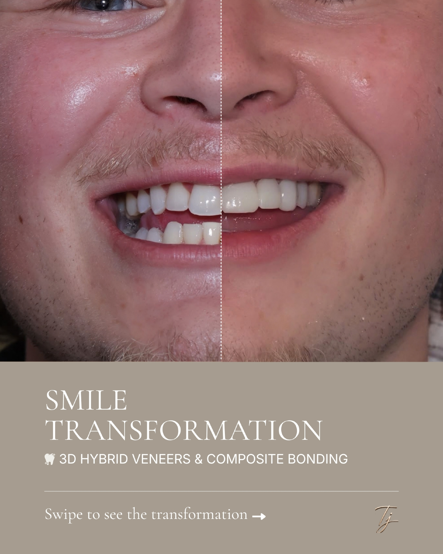 The part of my work I love most is creating smiles that feel completely unique to each of my patients, where every detail works together to create a… — image 1 of 3