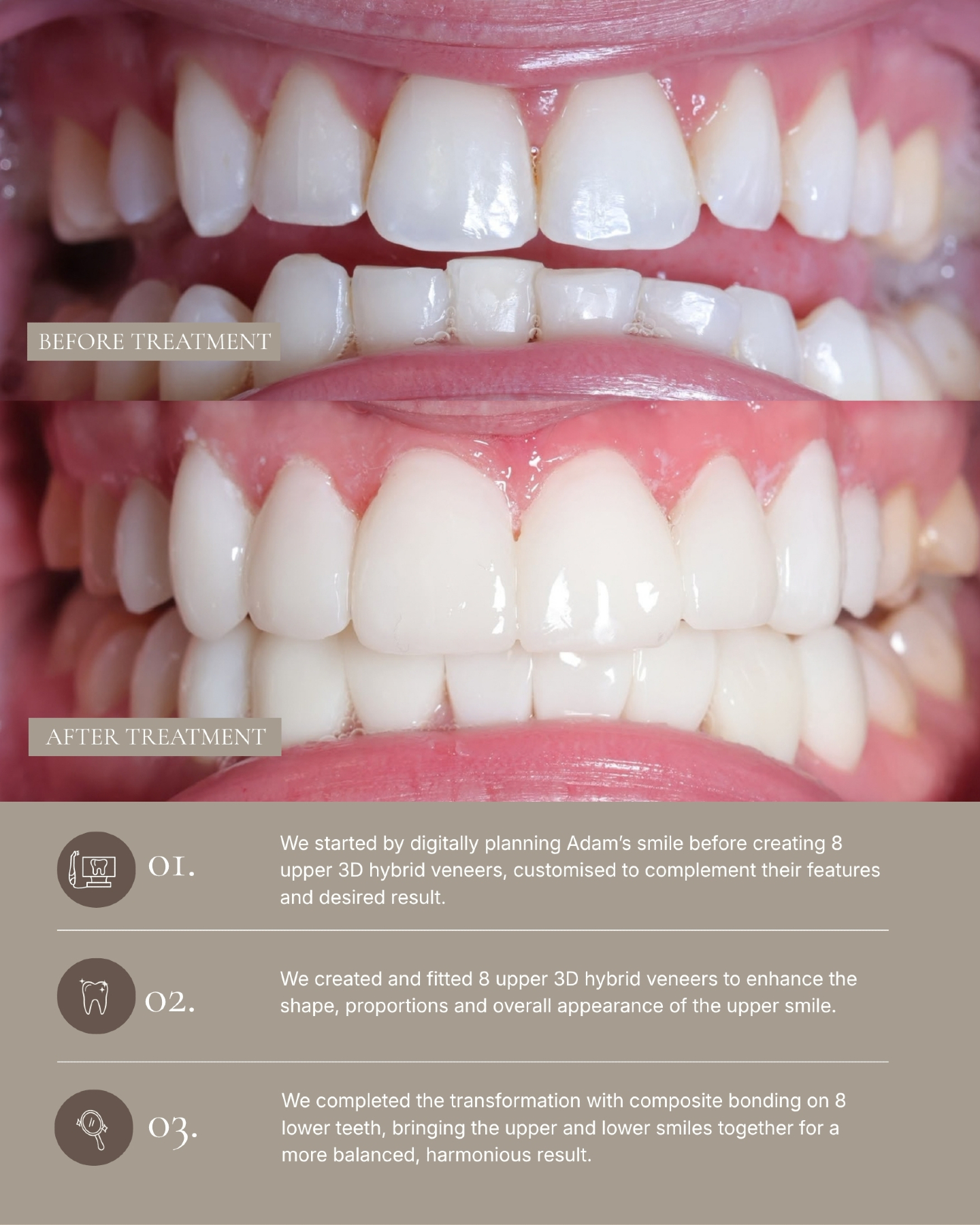 The part of my work I love most is creating smiles that feel completely unique to each of my patients, where every detail works together to create a… — image 3 of 3