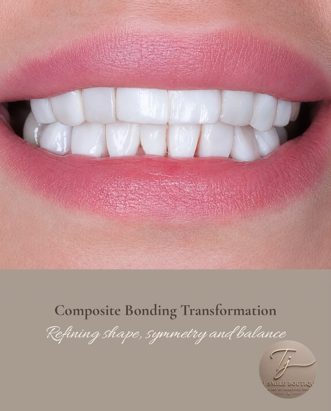✨ A smile doesn’t have to be perfect to be beautiful—it just needs the right balance. For this patient, the goal wasn’t simply to create a whiter… — image 2 of 3