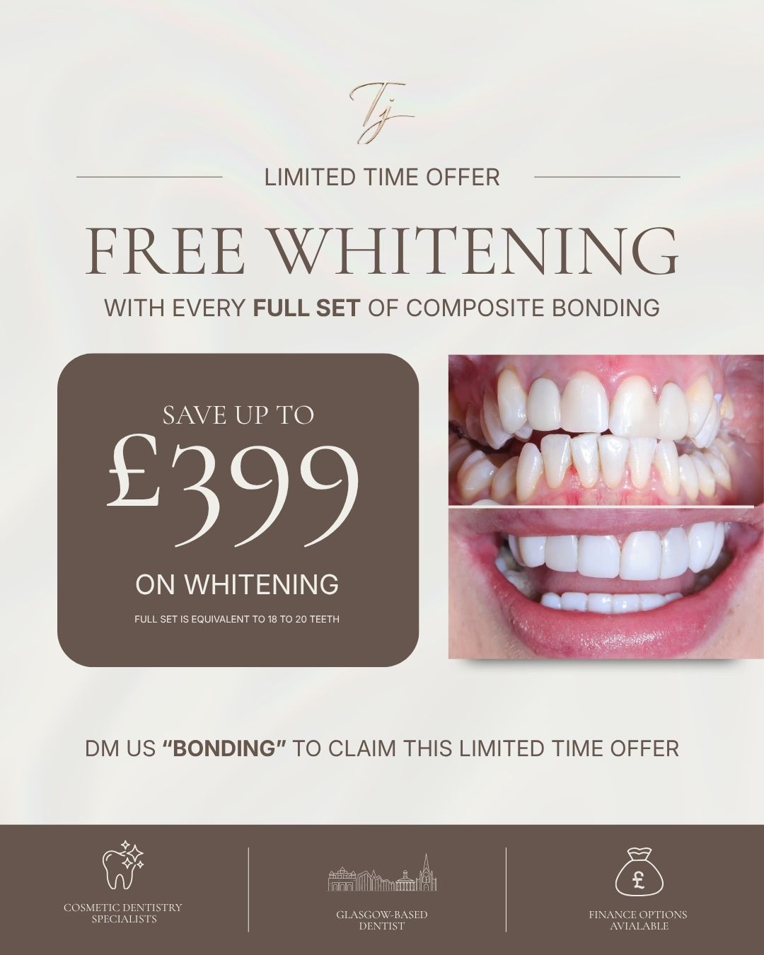 TJ Smile Studio October offer: free whitening, worth up to £399, with every full set of composite bonding